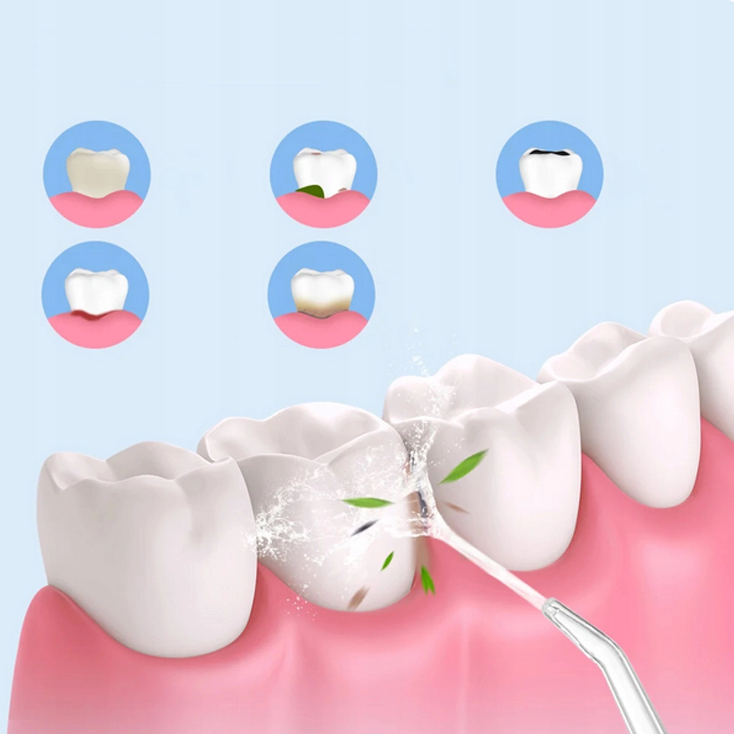 Irygator dentystyczny